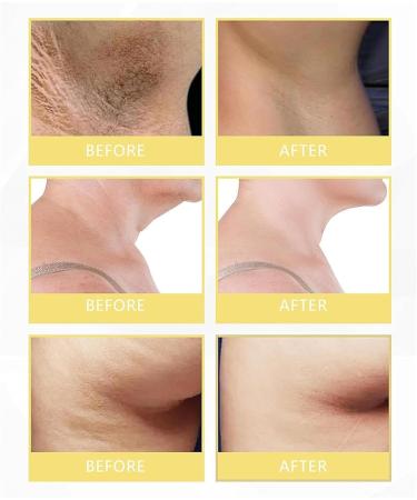 EXQST Underarm Whitening Cream Armpit Whitening Cream Brightening Moisturizing Body Cream Bleaching Cream for Dark Skin and Private Parts - Buy Online on GoSupps.com