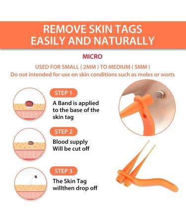 Mole & Skin Tag Removal Kit - Professional 2-in-1 Painless & Safe Wart Remover for Face & Body Care - Buy Online on GoSupps.com