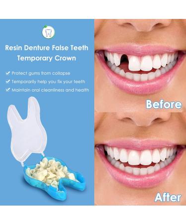 50pcs/Box Resin Temporary Crown for Front Teeth - False Teeth Material for Oral Care - Buy Online on GoSupps.com