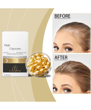  Generisch Hair Restoration Capsules - Pack of 30 Ginger Hair Growth Capsules - Anti-frizz - Regenerates and thickens hair by nourishing the scalp and hair follicles - Buy Online on GoSupps.com
