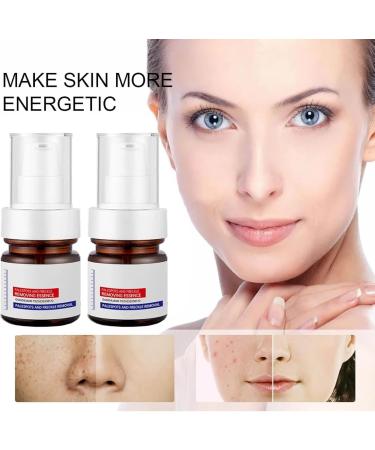  And Removing Essence Vitamin C Face Cream Anti-Spot Serum - Remover Freckle Essence Creams (1PCS) - Buy Online on GoSupps.com