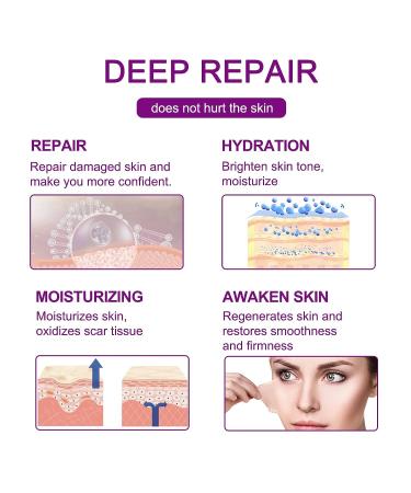 Joyeee Silicone Scar Tape Roll for Professional Scar Removal - Reusable Self Adhesive Silicone Strips for C-Section Surgery, Burn, Keloid, Acne - 1.6 x 60 - Buy Online on GoSupps.com