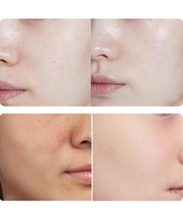 Hyaluronic Acid 2% + B5 Hyaluronic Acid For Face Hydrated Hyaluronic Acid Serum for Face Dark Spot Remover for Face Skincare Serum Lightweight Face Serum 30ML - Buy Online on GoSupps.com