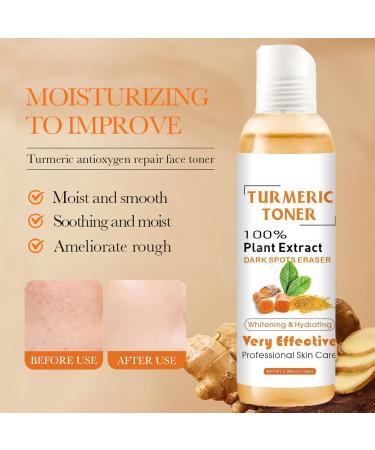 Turmeric Face Toner Dark Spots Skin Toner for Face Turmeric Hydrating Face Toner for Dry Skin Turmeric Oil Toner Serum Reduce Dark Spots & Acne Daily Skincare Toner Moisturiser Day & Night Use-118ml - Buy Online on GoSupps.com