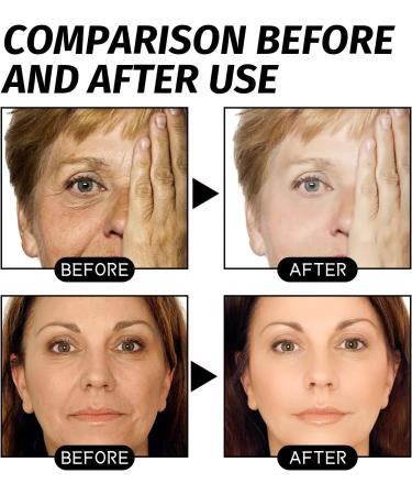 Retinol Gold Mask Retinol Snake Venom Gold Mask Anti-aging Face Mask Gold Face Mask Retinol Snake Venom Gold Mask Rejuvenating Gold Peel off Mask Anti-aging Gold Face Mask - Buy Online on GoSupps.com