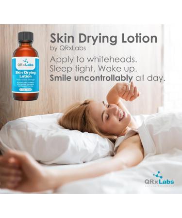 Drying Lotion - Alcohol-Free Acne Spot Treatment with Sulfur & Salicylic Acid - 1 fl oz - Buy Online on GoSupps.com
