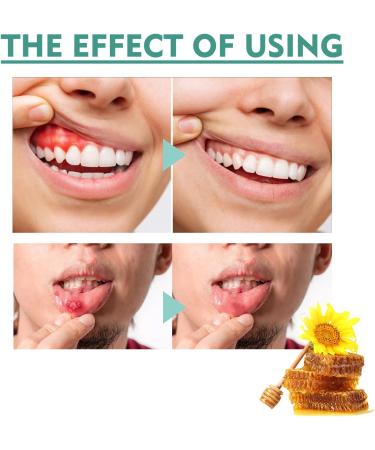 Artelac Mouth Bleeding Relief Spray - Soothing Oral Care for Mouth Ulcers Bad Breath and Gum Health - Buy Online on GoSupps.com