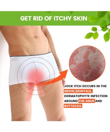 2 pieces herbal itch cream skin therapy cream dermatitis ointment moisturizing and caring effectively relieves itching and dryness of the skin suitable for men and women - Buy Online on GoSupps.com
