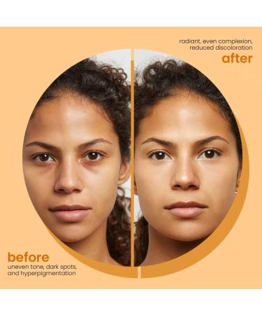  Sgjwyc Set of 3 lightening soaps with lemon turmeric and kojic acid turmeric shower gel for women for the face for all skin types - Buy Online on GoSupps.com