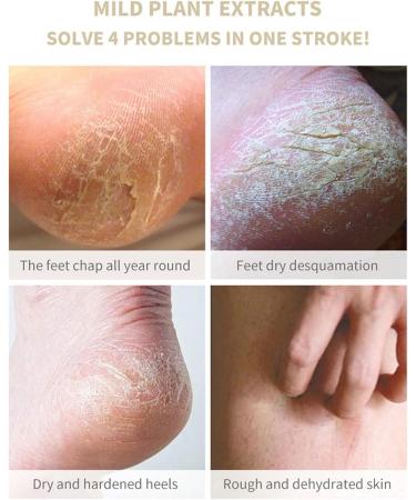 Foot Heel Cream | Foot Cream for Dry Cracked Heels - Dry Foot Repair Gel 100ml for Knees Elbows and Hands Moisturizing for Feet Foot Kasmole - Buy Online on GoSupps.com