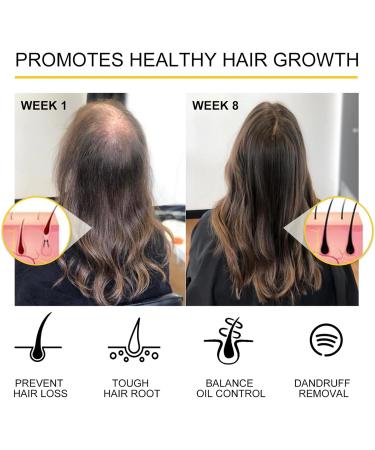 Ginger Hair Growth Serum | Anti Hair Loss & Thinning | For Men & Women | 35ml - Buy Online on GoSupps.com