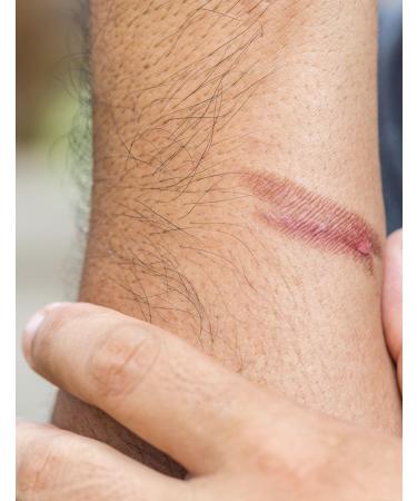 Ultimate Foot Cream & Mask - Organic Shea Butter Vitamin E Zinc - For Extreme Dryness Cracks & Baby Rash - Non-Greasy & Non-Comedogenic - 4oz - Buy Online on GoSupps.com