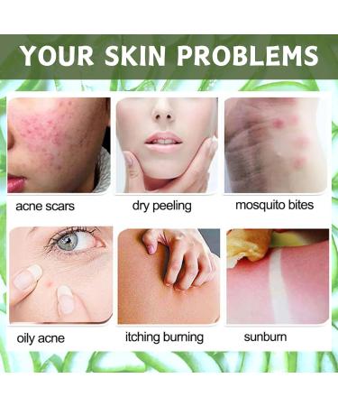 Aloe Vera Exfoliating Scrub Cleanser Aloe Vera Gel Face Wash Natural Acne Face Wash Face Wash For Men & Women Cream Cleanser For Acne Prone & Oily Skin Face Wash - Soothe Purify Facial Skin Care Green-Aloe Vera - Buy Online on GoSupps.com