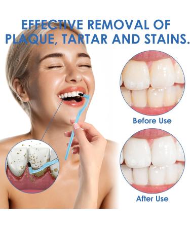 3-Piece Toothbrush Stain Remover Set | Jinsihu Tartar Remover for Professional Tooth Cleaning & Plaque Removal - Buy Online on GoSupps.com