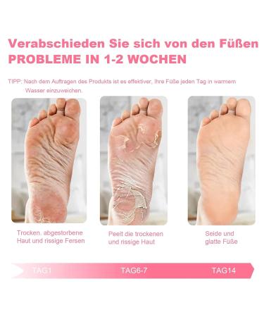 Buy SDSM Foot Mask for Hard Skin - 2 Pairs of Peeling Socks for Dead Skin & Cracked Heels - Plant-Based Moisturizing Formula for Baby Soft Feet (Rose) - International Shipping Available - Buy Online on GoSupps.com
