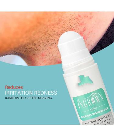 Hair Inhibitor 100ml Roll-on Serum for Ingrown Hair & Razor Bumps | After Shave Repair Solution for Men & Women | Skin Lightening for Bikini Area, Legs & Underarms - Buy Online on GoSupps.com