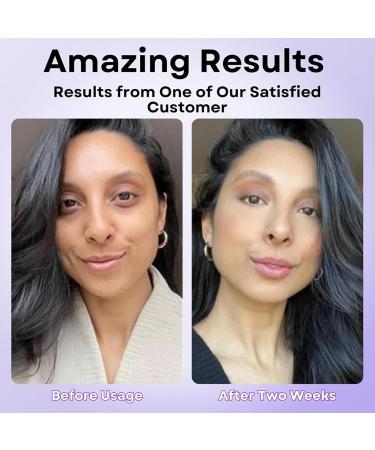 Anti-Puffiness Eye Cream Instant Temporary Firming Cream Moisturizing Eye Cream for Eye Bags and Under Eye Bags (3Pcs) - Buy Online on GoSupps.com