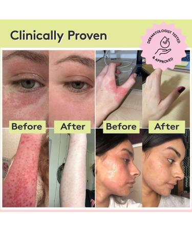 Delhicious Migh-Tea Moisture Body Balm - Natural & Vegan Shea Butter for Dry Skin Eczema & Psoriasis Relief - 70g Ayurvedic Body Butter - Buy Online on GoSupps.com