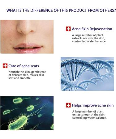 BIOAQUA Skin Care Acne Face Treatment Removal Cleanser Cream Spots Scar Blemish Mark 100g - Buy Online on GoSupps.com