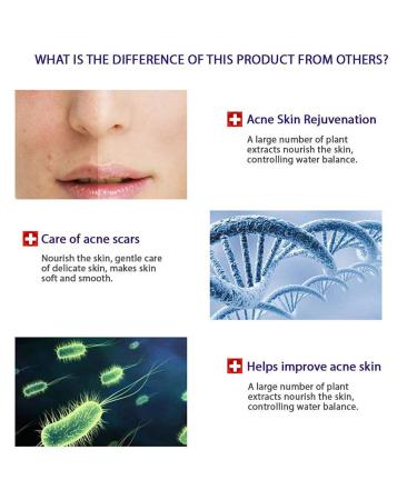 BIOAQUA 4-in-1 Acne Treatment & Scar Removal Cream - 100g + 30g + 30ml + 4pcs | Moisturizing Face Masks for Blemish Marks & Spots - Buy Online on GoSupps.com