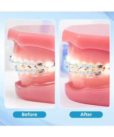 500pc Annhua Dental Orthodontic Rubber Bands | Teeth Gap & Crooked Teeth Braces | Monkey 4.5oz 3/8 - Buy Online on GoSupps.com