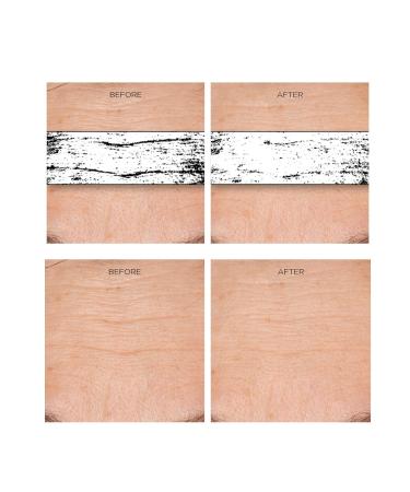 Rejuvenation Serum for Line Lifting & Crow's Feet - Anti-Aging Solution | Shop Internationally - Buy Online on GoSupps.com