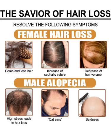 QDHGCFOC Rice Water Hair Oil Hair Serum Natural Rice Essence Nourishing Hair Serum Natural Rice Milk Serum Strengthens Scalp Improves Hair Condition - Buy Online on GoSupps.com