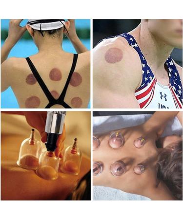 Cupping Therapy Set - Professional Chinese Massage Kit with 12 Therapy Cups and Pump - Buy Online on GoSupps.com