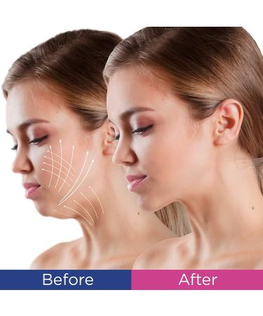 NOVAPHOLIA Double Chin Reducer Face Lift Mask - V Line Lifting Strap for Women - 5 Pcs Chin Slimming Mask - Buy Online on GoSupps.com