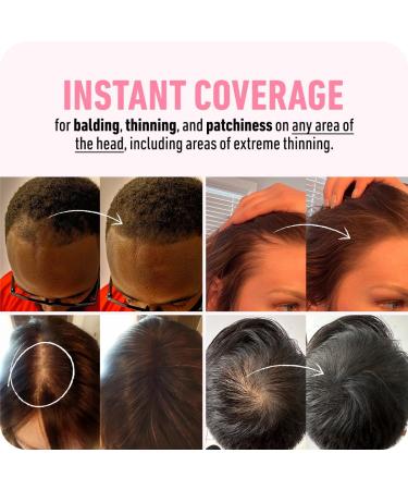 BOLDIFY Hairline Powder - LARGER 10g Bottle - Root Touch Up Powder - Instantly Conceals Hair Loss - Hair Toppers for Women & Men Hair Powder for Thinning Stain-Proof 48 Hour Formula (Light Blonde) 10 g (Pack of 1) Light Blonde - Buy Online on GoSupps.com