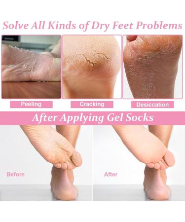 Zuroki Gel Socks - Moisturizing Spa Foot Care for Soft Feet | Reusable Cornea Socks | Ideal Gift for Women | 2 Pairs - Buy Online on GoSupps.com