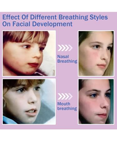 200 Pcs Gentle Sleep Strips for Mouth Breathing & Snoring Relief - Improve Night Sleep! - Buy Online on GoSupps.com