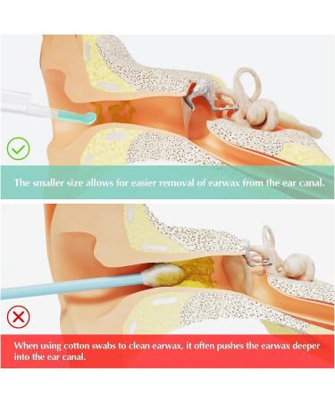 8 Pcs Soft Silicone Ear Scoop Set - Replacement Ear Wax Removal Tool with Camera for Earwax Cleaner - Buy Online on GoSupps.com
