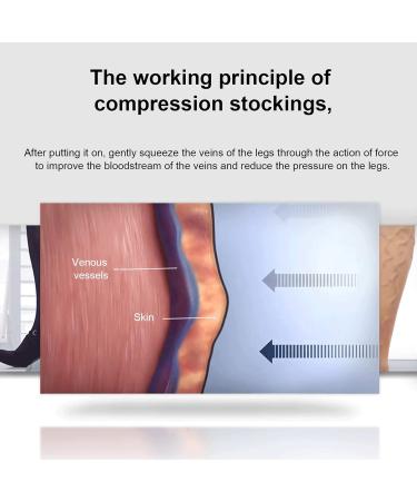 Keenso High Compression Open Toe Stockings for Varicose Veins Surgery - Mid Tube Size (S) | International Shipping Available - Buy Online on GoSupps.com