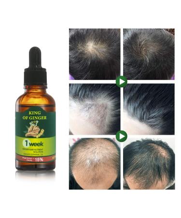 Ginger Hair Growth Serum- Stop Hair Loss & Support Healthy Hair - 30ML (1.01 Fl oz) - Buy Online on GoSupps.com