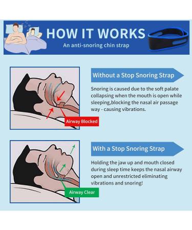 Adjustable Anti-Snoring Chin Strap for Men and Women - Breathable Reducing Device to Help Sleep Better - Buy Online on GoSupps.com