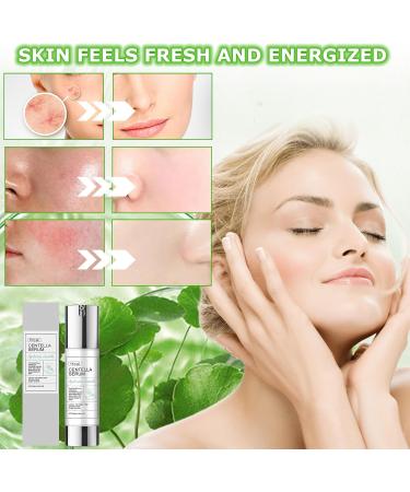 exatta 50 ml Repairing Essence Centella Centella Complex Reedle Shot Hyaluronic Acid for a dull green propolis extract for dull tired skin - Buy Online on GoSupps.com