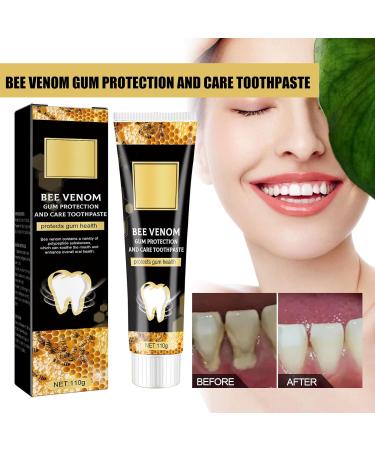 Dyceittdia Gum Protection Toothpaste - 2pcs 110g | Deep Cleaning Stain Removal & Whitening - Buy Online on GoSupps.com