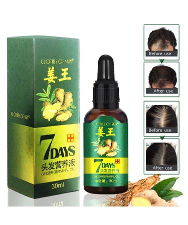Advanced Hair Growth Serum - Accelerate Growth Thicken & Regrow Hair Anti-Hair Loss Treatment for Thin Hair - Buy Online on GoSupps.com