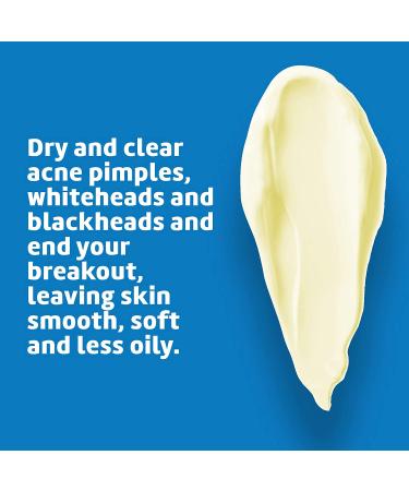 De La Cruz Acne Treatment Ointment - 10% Sulfur Maximum Strength, 2.6 oz - Buy Online on GoSupps.com