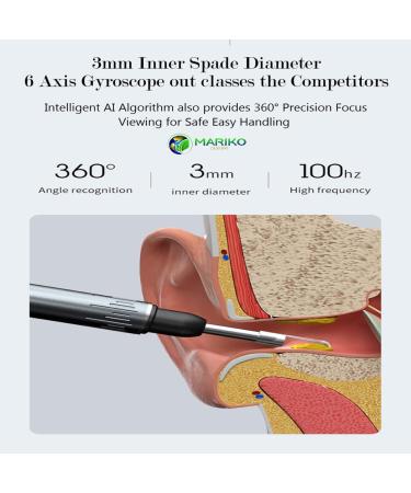 Mariko Designs Ear Wax Removal Tool Camera - 5 MP HD Camera, 6 LED Lights - Earwax Cleaner Kit for iOS/Android - Ear Picker Endoscope/Otoscope - Buy Online on GoSupps.com