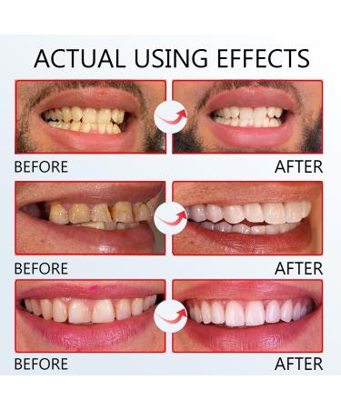 SP-8 Probiotic Toothpaste for Fresh Breath | Deep Cleaning Care | International Shipping - Buy Online on GoSupps.com