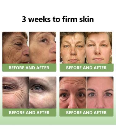 Stdei Luxurious Collagen Firming Cream Stdei Luxurious Collagen Firming Cream Stdei Firming Cream Advanced Firming & Wrinkle Reducing Cream Collagen Body Lotion Firming (3) - Buy Online on GoSupps.com