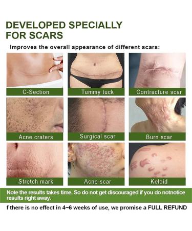 GOOPGEN Advanced Scar Repair Serum - Medical Grade Formula for Acne, Surgical & Stretch Marks (5pcs) - Buy Online on GoSupps.com