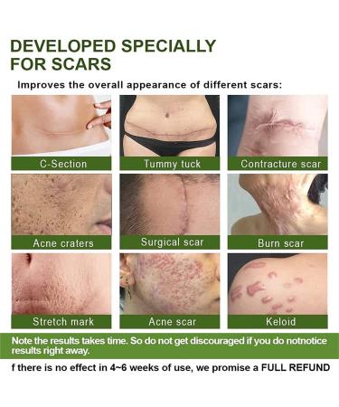 Goopgen Advanced Scar Repair Serum - Medical Grade Nature Scar Treatment for All Types of Scars - Buy Online on GoSupps.com