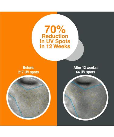 Photozyme DNA Repair Enzymes GFS Plus Facial Night Serum | 0.5% Retinol Anti-Aging Skincare | Dark Spot Corrector for Fine Lines & Acne Scars | Non-Irritating Beauty Treatment - Buy Online on GoSupps.com