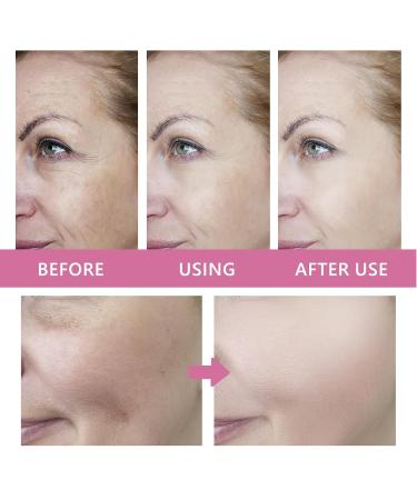4-in-1 Deep Moisturizing Cream with Retinol & Ceramides - Anti-Aging Face Neck & Chest Cream - Firming Wrinkle Reduction for All Skin Types - Buy Online on GoSupps.com