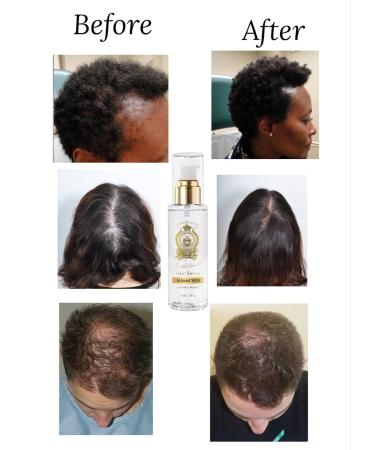 Argan Oil Hair Serum - Anti Frizz Organic Hair Oil for Thicker & Longer Hair - Hydrating Vitamin E Serum for Dry Damaged Hair - Buy Online on GoSupps.com