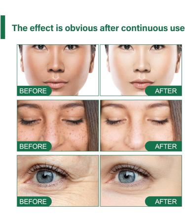  JPSDOWS Whitening Cream Underarm Whitening Cream for Women 100ml Intimate Lightening Gel for Body Face Bikini and Sensitive Areas and Specific Lightening - Buy Online on GoSupps.com