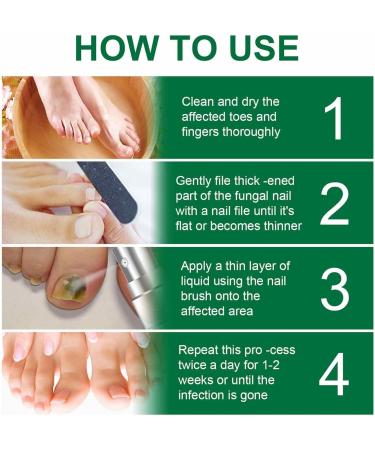 FASSME Nail Repair Essence toenail solution nail repair nursing solution of gray nails safe and effective repair discolored damaged nails 10ml - Buy Online on GoSupps.com